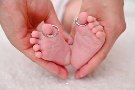 借卵生子机构孕妇怎样预防妊娠纹